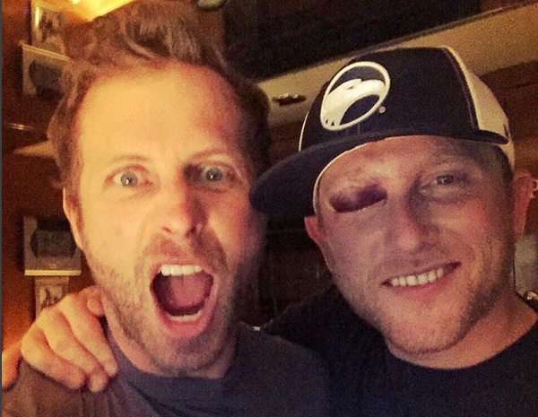 Cole Swindell Suffers Serious Black Eye Over Memorial Day Weekend