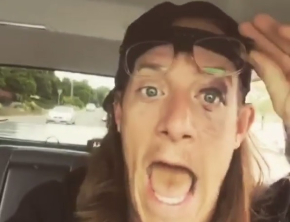 Tyler Hubbard Shows Off Black Eye in Instagram Video